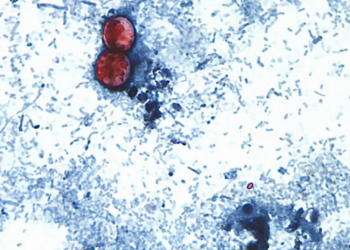 virus