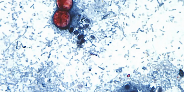 virus