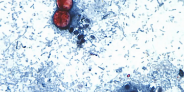 virus